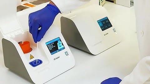 Testing is the backbone of response to COVID-19