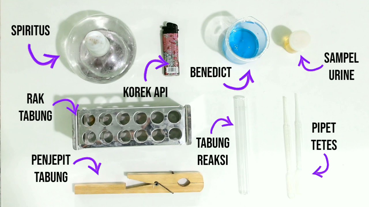 [EDUTELKI 2021] TLM Politeknik Kesehatan Muhammadiyah Makassar | Pemeriksaan reduksi urine
