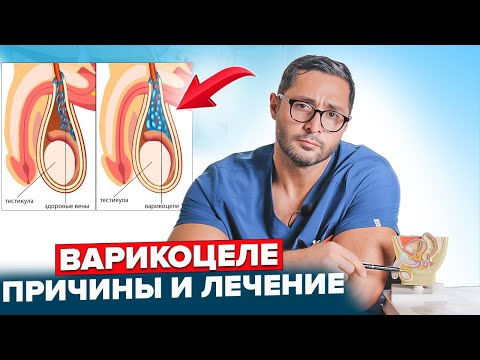 Как обнаружить Варикоцеле и кому нужна операция