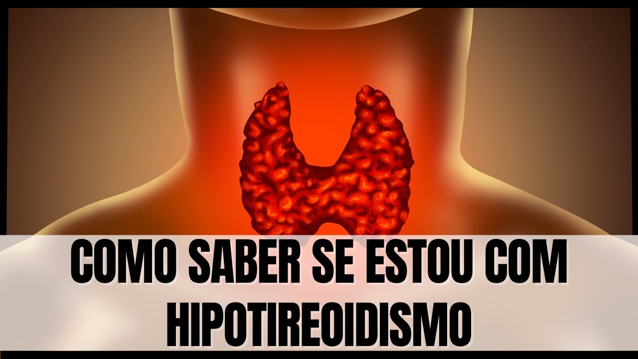 Como saber se estou com hipotireoidismo - YouTube