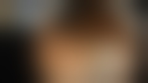 Dr. Douglas Rex: EMR of the Transverse Colon with Eleview™