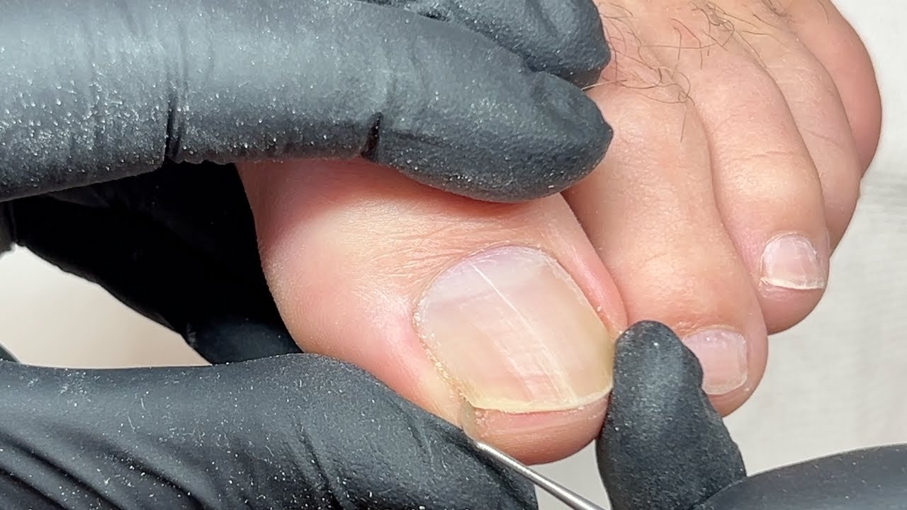 Guys want to have nice feet too! How I do basic dry pedicure