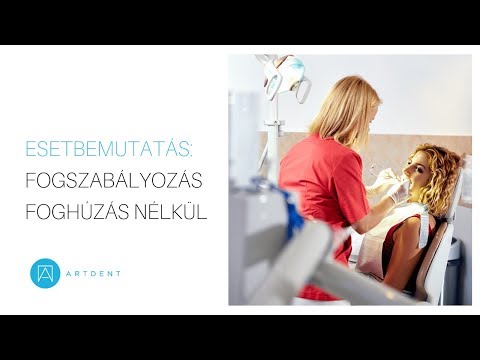 Videó: Hogyan lehet munkát találni az Egyesült Államokban (képekkel)