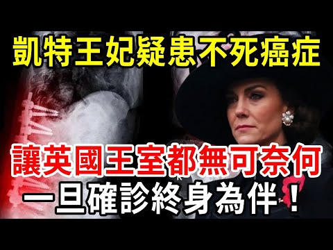 英國王室為世人敲響警鐘！凱特王妃疑患不死癌症，一旦確診終身為伴！這，到底是個什麼病，讓王室都無可奈何？【中老年講堂】