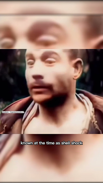 shell shock experienced by soldiers.