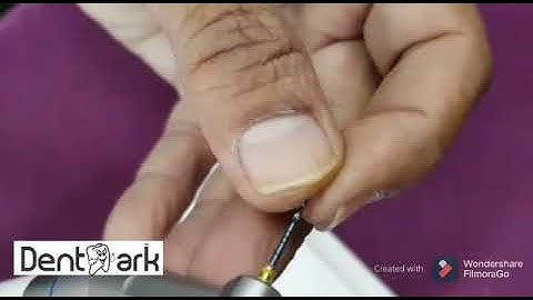 DENTMARK ENDOMOTOR ELITE PRO WITH INBUILT APEXLOCATOR (APEX-S)