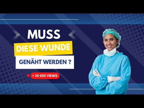 Video: Wann sollte eine Platzwunde genäht werden?