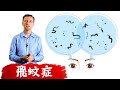 (眼睛3)飛蚊症最佳療法,糖尿病眼睛困擾,柏格醫生Dr berg