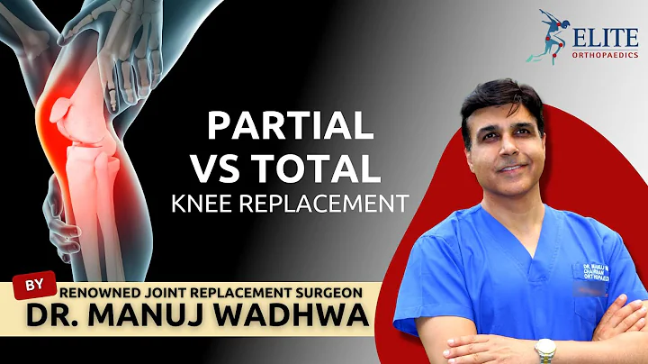Partial or a Total  Knee Replacement - Dr. Manuj W...