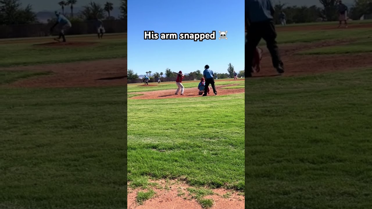 Pitcher S Arm Snaps Shorts Baseball Pitching