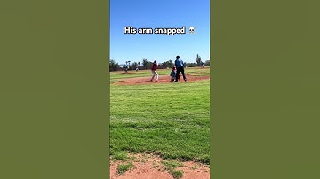 Pitcher’s arm snaps #shorts #baseball #pitching