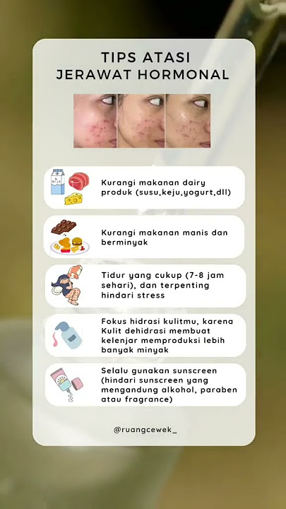 Tips Atasi jerawat hormonal ‼️ #fyp シ #fypp #fyp  #skincare