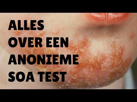 Alles Over Een Anonieme Soa Test | Hoe Gaat Een Soa-Test?