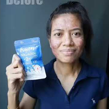 frozen collagen asli 100% ORIGINAL buruan order 085749133006