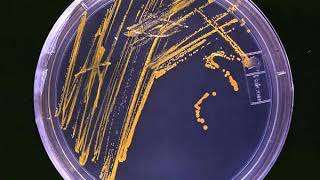 Microbiology | Wikipedia audio article
