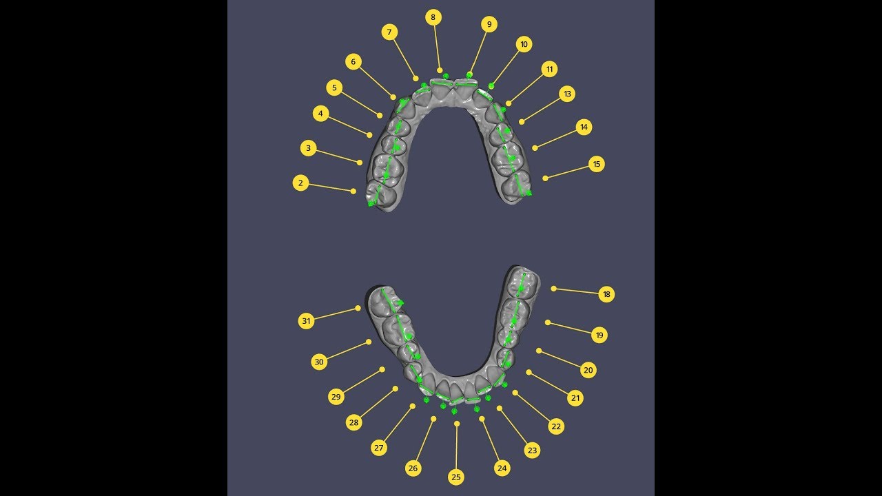 Simplyceph 3DS teeth marking and selecting crowns