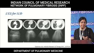 INPF lecture series: Autoimmune ILD – applying ACR/ACCP guidelines 2023: Dr Kavitha