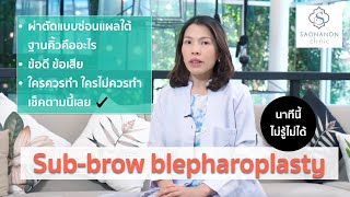 การผ่าตัดตกแต่งเปลือกตาซ่อนแผลใต้ฐานคิ้ว (Sub-brow blepharoplasty) #ตาสองชั้น #หางตาหย่อน #subbrow