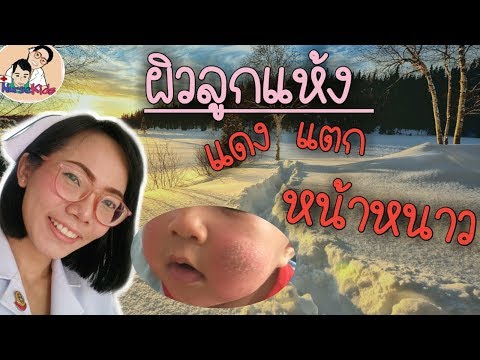 ผิวลูกแห้ง แดง แตก จากอากาศหนาว ใช้อะไรทา ดูแลผิวลูกยังไง|Nurse Kids