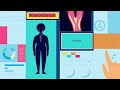 How Well Do You Know Your Heart? Part 2: Symptoms of Atherosclerosis