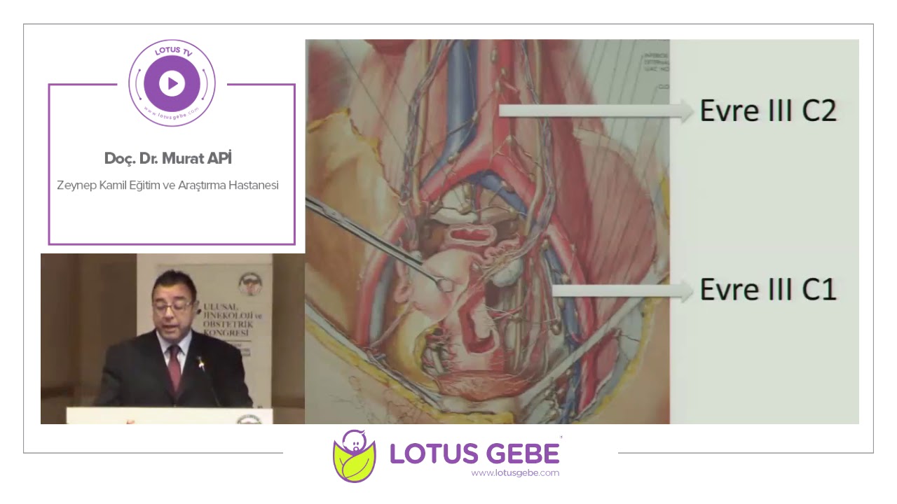 Doç. Dr. Murat Api - Endometrium Kanseri