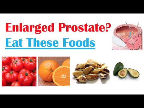 Best Foods to Eat with Enlarged Prostate | Reduce Risk of Symptoms, Enlargement & Cancer