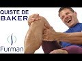 QUISTE DE BAKER | Dolor de rodilla | Causas - Síntomas - Tratamientos