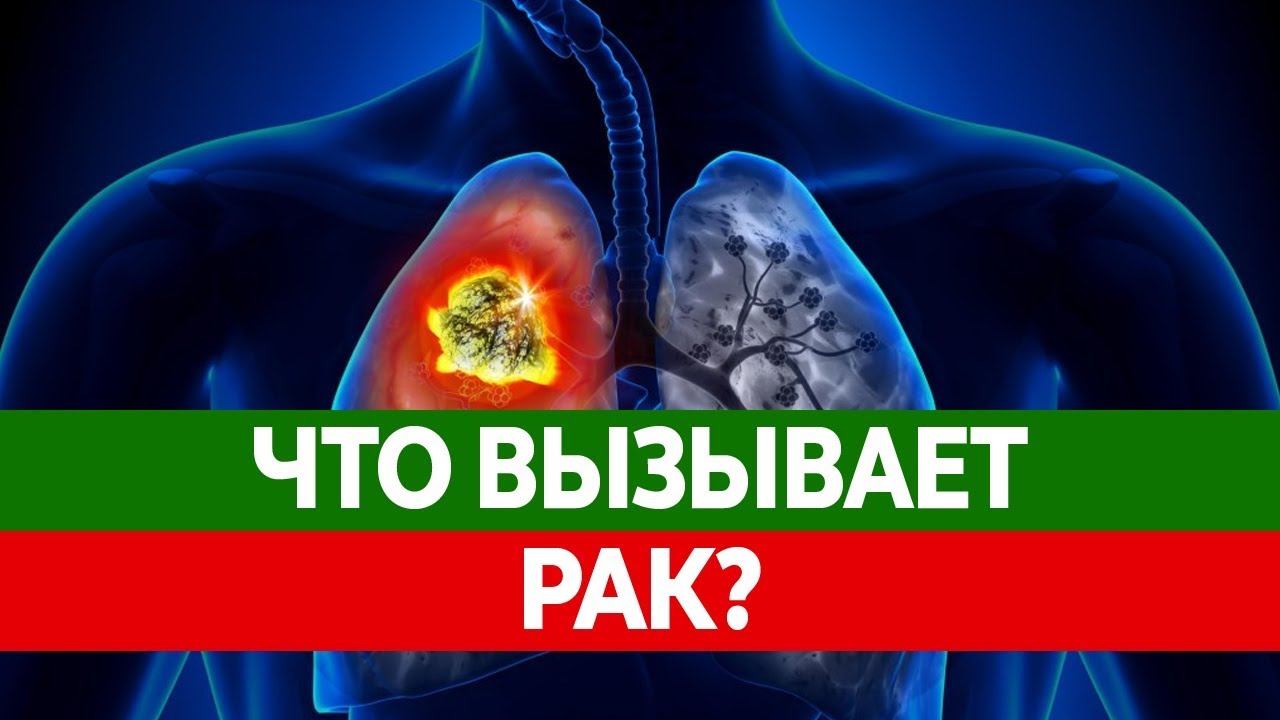 ПРИЧИНЫ РАКА. От чего рак? Откуда берутся раковые клетки