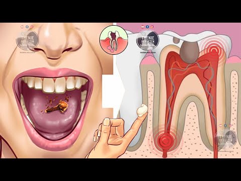 Video: A duhet të prekin dhëmbët kur përtypni?