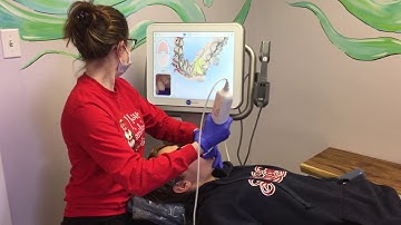 iTero - The Digital Impression Scanner in Action