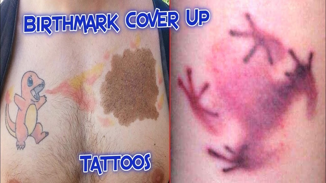 Tattoo over a birthmark  rpics