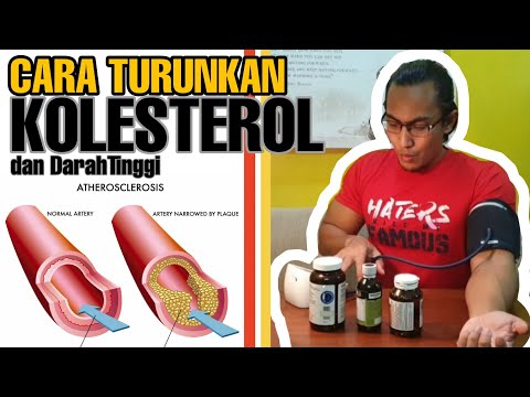 Video: Pedoman Terbaru Tentang Statin Untuk Kolesterol Tinggi