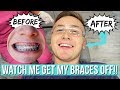 WATCH ME GET MY BRACES OFF!! *SATISFYING*