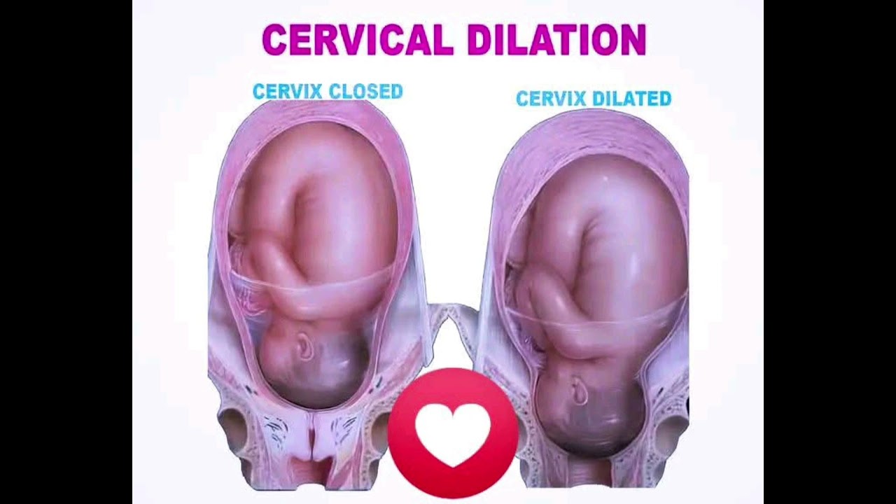 🔴 "Cervix Dilation Explained in Simple Words | Labor Process for Beginners"