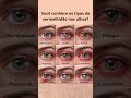 O SEU OLHO ESTÁ VERMELHO?#olhos #saude #short