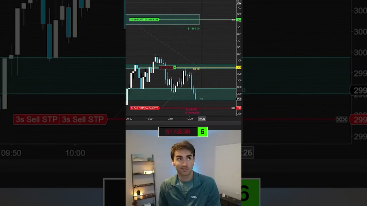 I’m Struggling With Scaling Into Trades