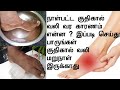 Tamil maruthuvam kuthikal vali kunamaka  tamil foot pain in the morning