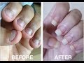 How To Stop Biting Your Nails.... FOR GOOD