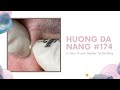 #174 | Huong Da Nang