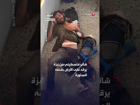 إصابة شاب فلسطيني ببتر في القدم قرب مركز توزيع مساعدات بغزة