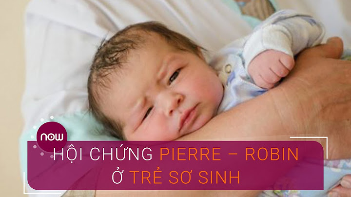 Chi phí phẫu thuật pierre robin là bao nhiêu năm 2024