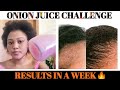 HOW TO USE ONION JUICE FOR FAST HAIR GROWTH || RIGHT WAY TO APPLY FOR EFFECTIVE RESULTS