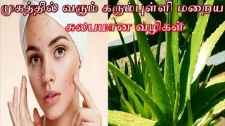 முகத்தில் வரும் கரும்புள்ளி மறைய சுலபமான வழிகள்