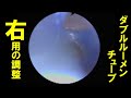 【気道確保】右用ダブルルーメンチューブ