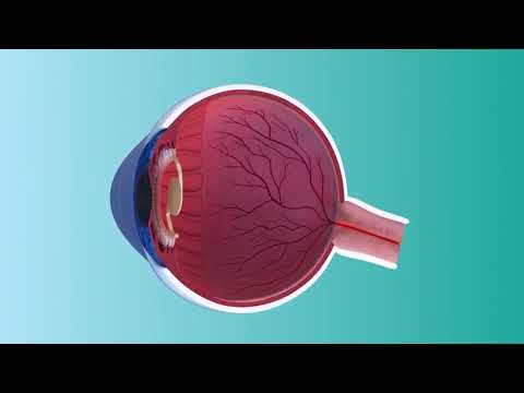 Vivity MOA Video