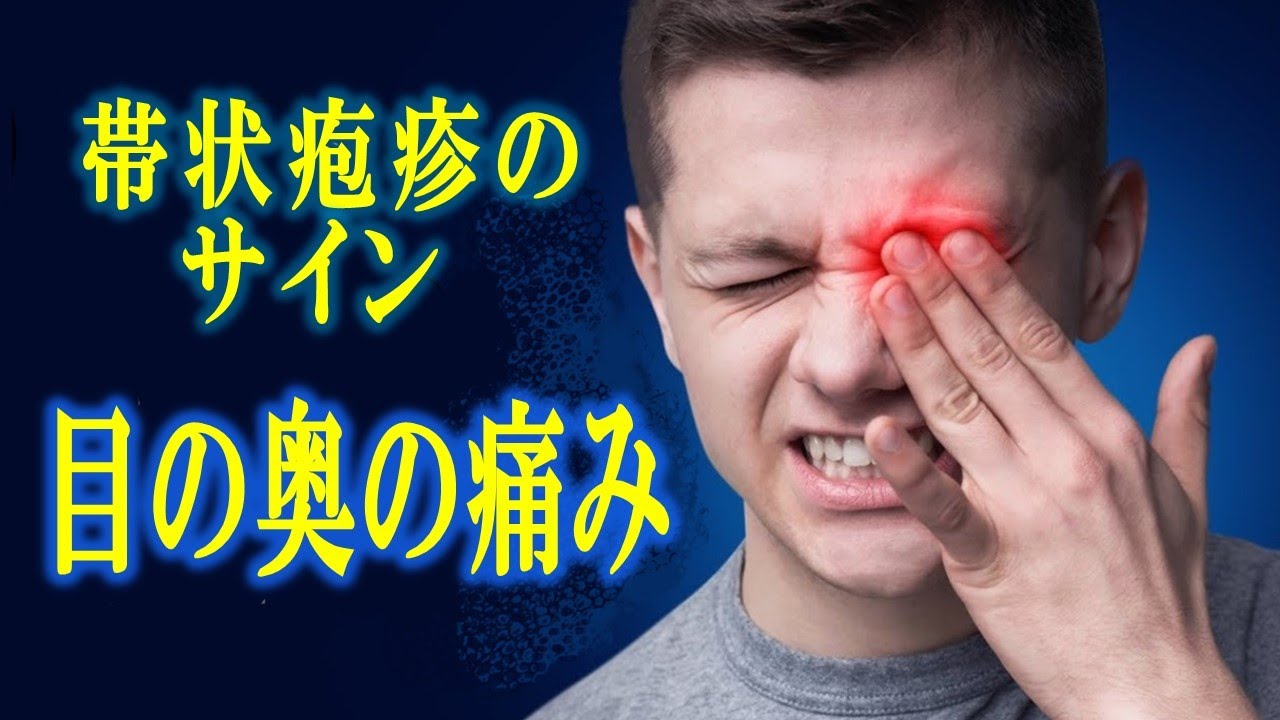 帯状疱疹の痛みがひどい場合、いつ医師の診察を受けるべきか