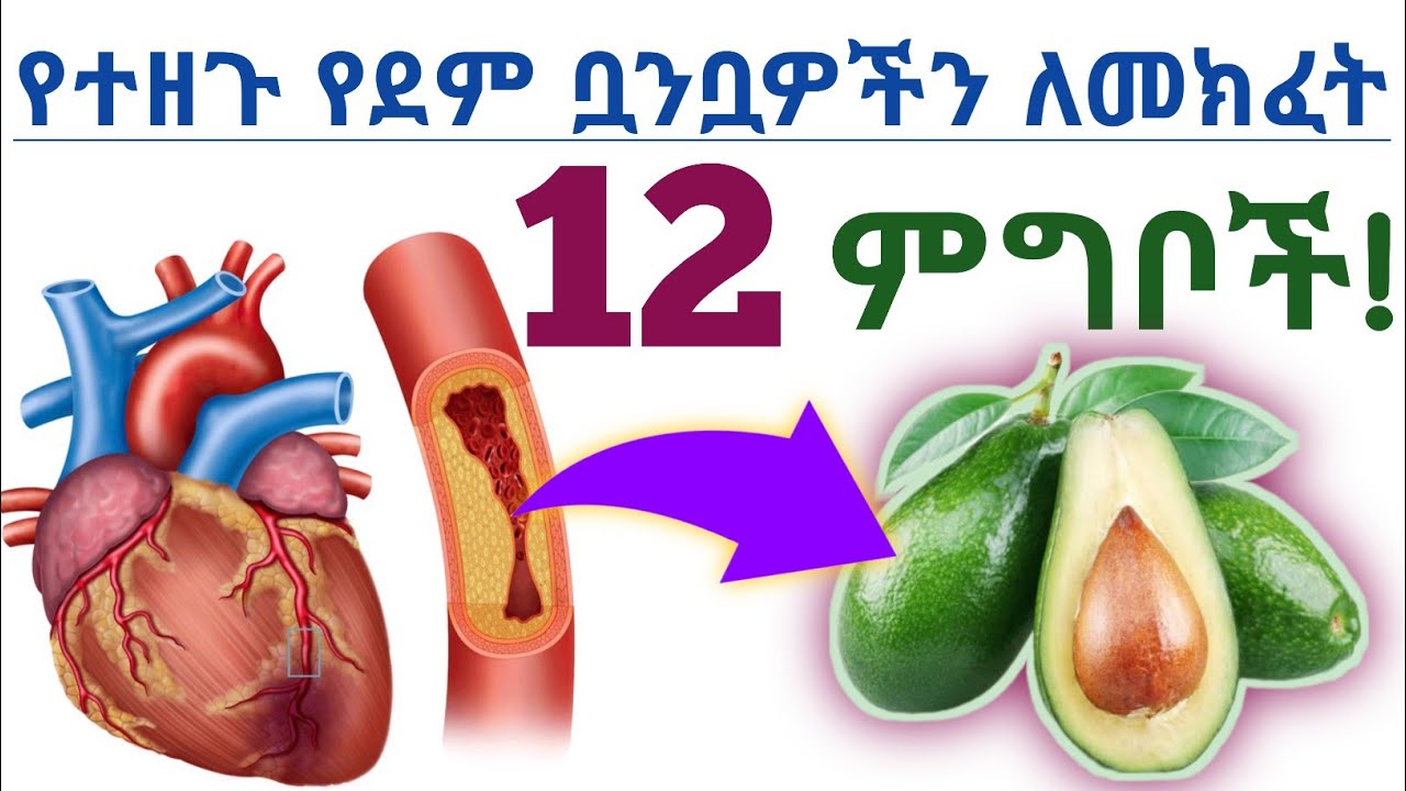 የተዘጉ የደም ቧንቧዎችን/Artery ለመክፈት እና ለማፅዳት የሚረዱ 12 ጤናማ ምግቦች| 12 Foods to unclog and cleanse artery