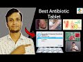 Amoxyclav 625 Tablet Use in Hindi | Amoxycillin& Clavulanate Tablet Use | SK MEDICINE