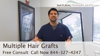 Multiple Hair Grafts & Natural Hair Growth | Hair Transplant Maryland