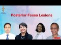 Posterior fossa lesions